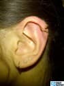 61131
