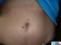 56254