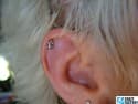 10171