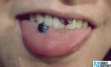 101144